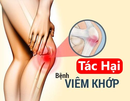 Tác hại của bệnh viêm khớp